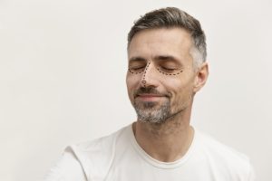 Rinoplastia com enxerto de cartilagem