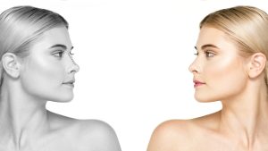 Rinoplastia primária e secundária
